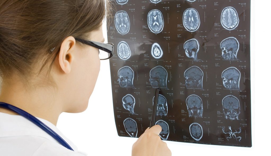 How an Attorney Can Help Victims of Traumatic Brain Injuries